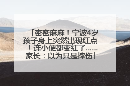 密密麻麻！宁波4岁孩子身上突然出现红点！连小便都变红了……家长：以为只是摔伤